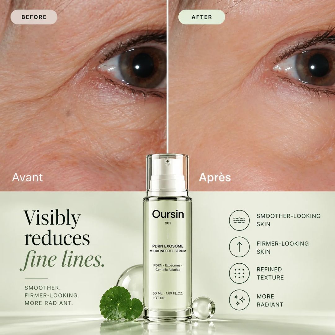PDRN Exosome Microneedle Serum